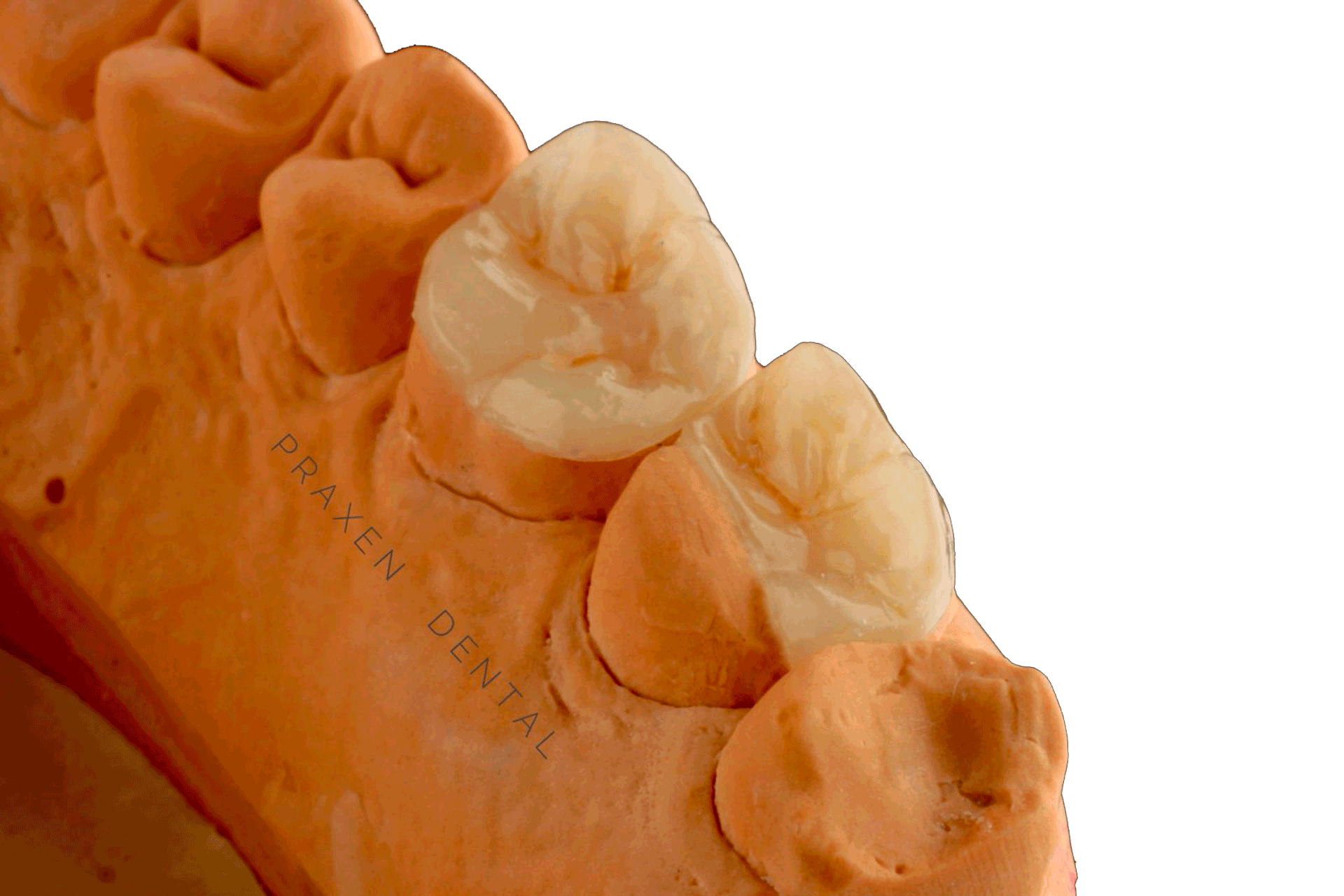 Micro-estratificación cerámica