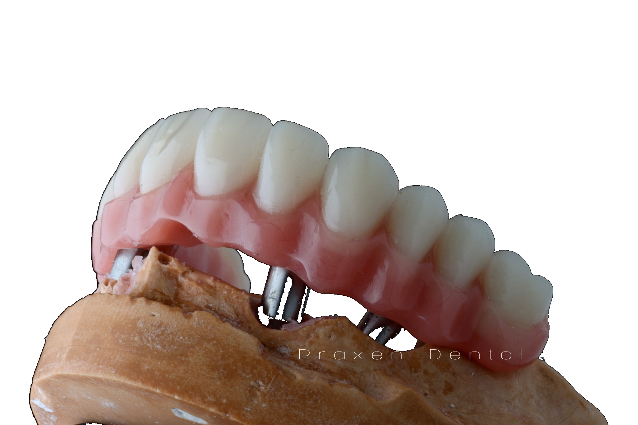 Glaze